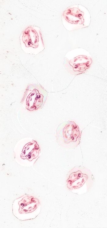 Media type: image; Special Collections 3992   shows specimen_part histological serial section;